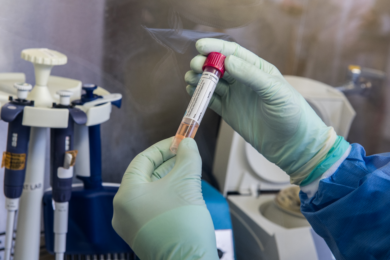 "Gloved hands at a lab bench hold a red-topped specimen tube containing liquid. The label on the collection tube in unfilled. It does not contain any patient information. "