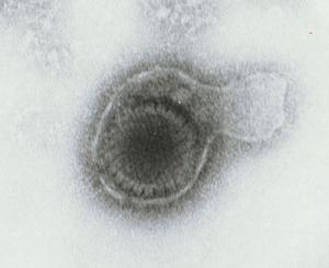 Herpesvirus