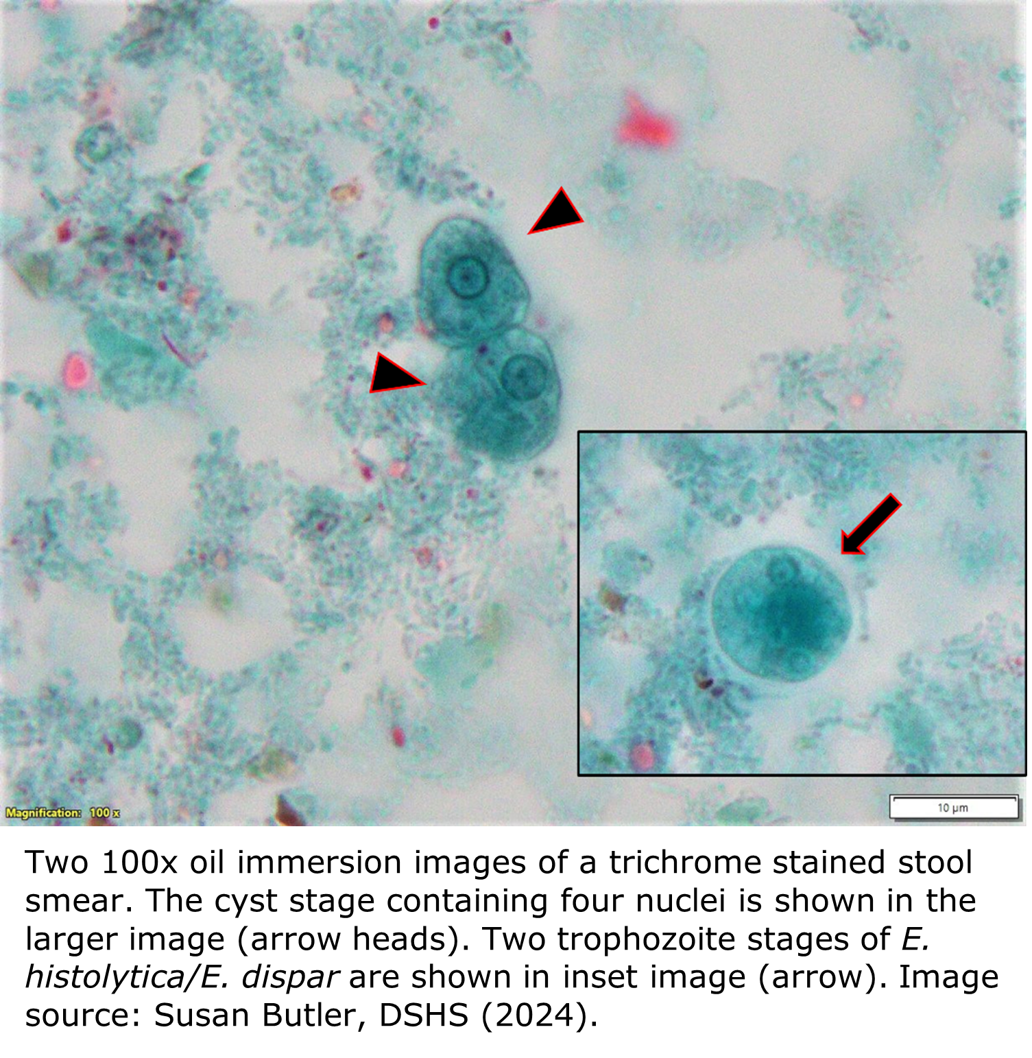 A micrograph of a trichrome stain of a stool specimen