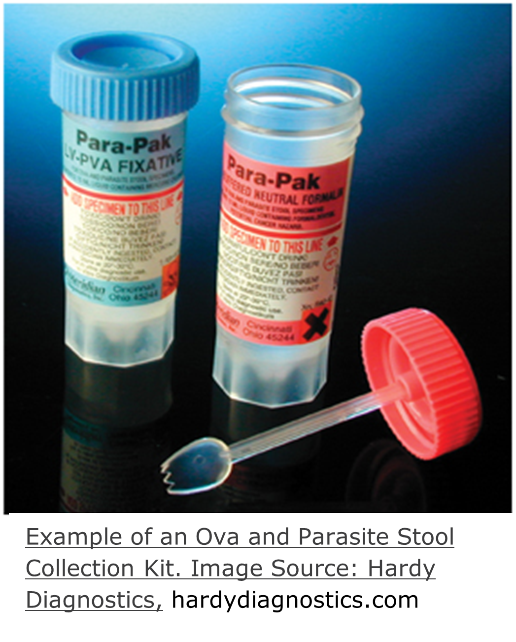 A photograph of a Ova and Parasite specimen collection kit