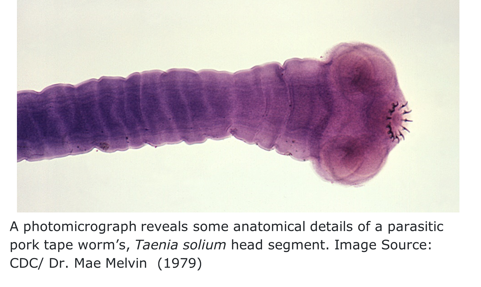 A close up of a purple-stained parasitic tapeworm. The head  (scolex) section is visible with several curved oral hooks at the top of the head. 